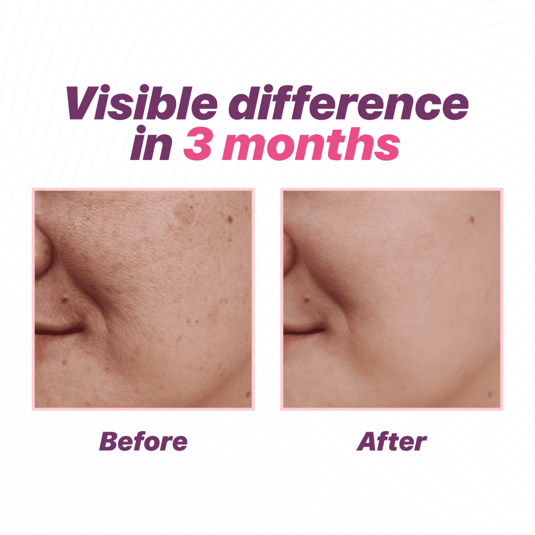 L-Glutathione for Radiant & Beautiful Skin | Nature’s Island